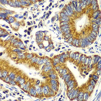 Immunohistochemistry - TOMM20 antibody (144-06774)