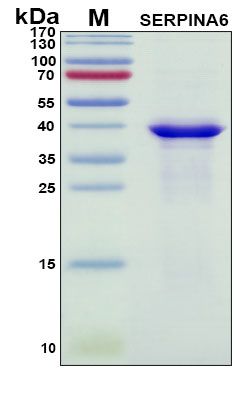 SDS-PAGE