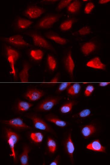Immunofluorescence - PPARD antibody (144-05656)