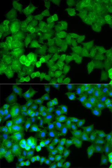 Immunofluorescence - JUP Polyclonal Antibody (144-00963)
