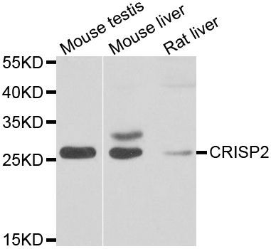 Western blot - CRISP2 antibody (144-07177)