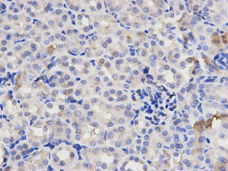 Immunohistochemistry - RELA Polyclonal Antibody (144-02547)