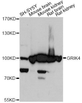 Western blot - GRIK4 antibody (144-60484)