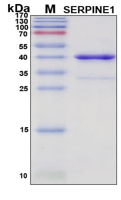 SDS-PAGE Image