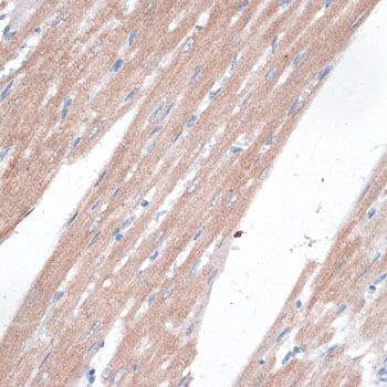 Immunohistochemistry - AHSP Polyclonal Antibody (144-06465)