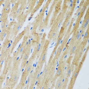 Immunohistochemistry - ADAM12 antibody (144-07940)