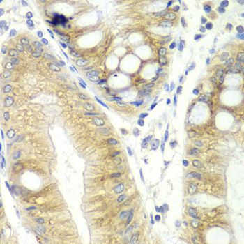 Immunohistochemistry - CES2 antibody (144-01514)