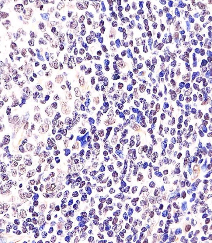 IHC-P