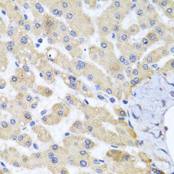 Immunohistochemistry - ABCB8 antibody (144-02653)