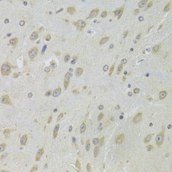 Immunohistochemistry - DHRS9 Polyclonal Antibody (144-06324)