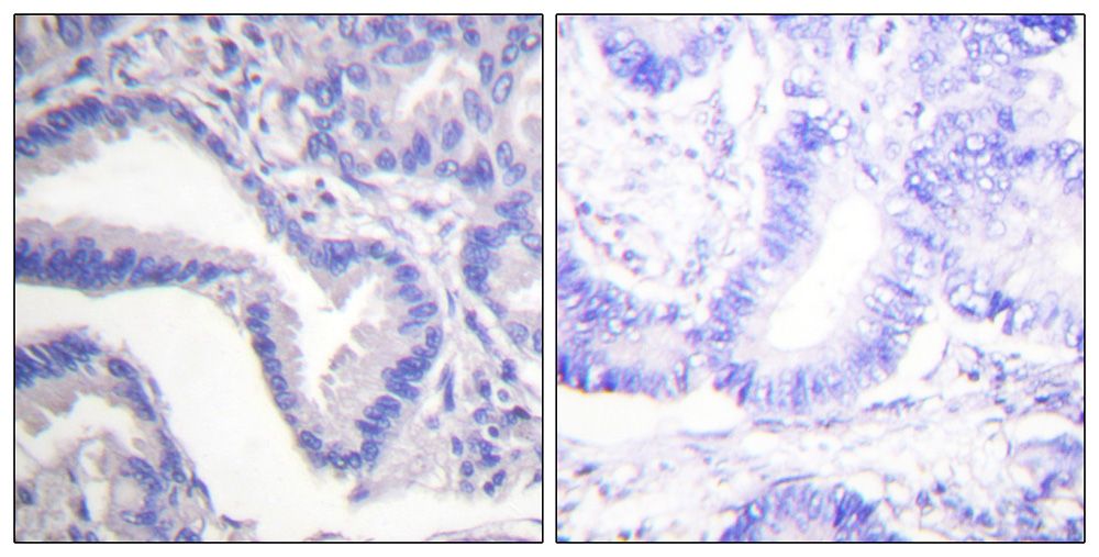 IHC