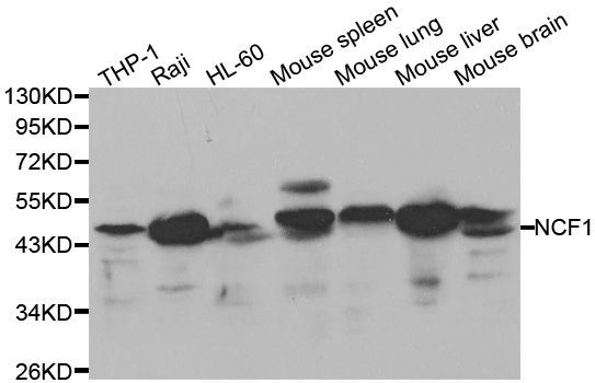 Western blot - NCF1 Polyclonal Antibody (144-01148)