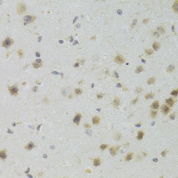 Immunohistochemistry - PAWR Antibody (144-03063)
