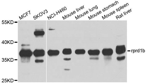 Western blot - RPRD1B Polyclonal Antibody (144-600492)