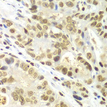Immunohistochemistry - IKBKB antibody (144-02087)