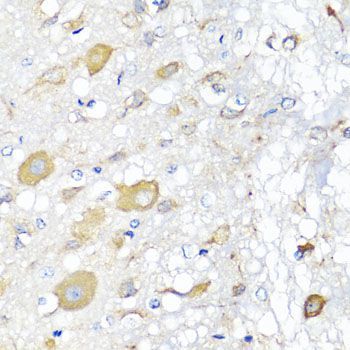Immunohistochemistry - CALHM1 antibody (144-07858)