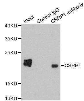 Immunoprecipitation - CSRP1 Polyclonal Antibody (144-01071)