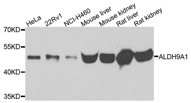 Western blot - ALDH9A1 Polyclonal Antibody (144-07875)