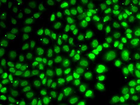 Immunofluorescence - XPO5 Polyclonal Antibody (144-06790)
