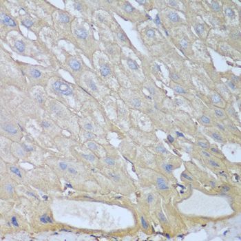 Immunohistochemistry - RPH3AL antibody (144-04311)