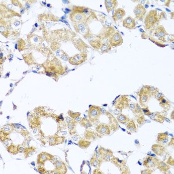 Immunohistochemistry - COQ7 antibody (144-07768)