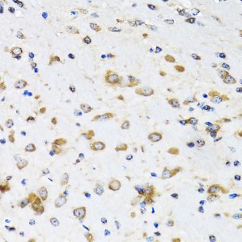 Immunohistochemistry - COPB2 Polyclonal Antibody (144-07036)