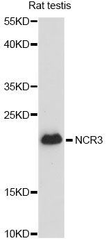 Western blot - CALM3 Polyclonal Antibody (144-60695)