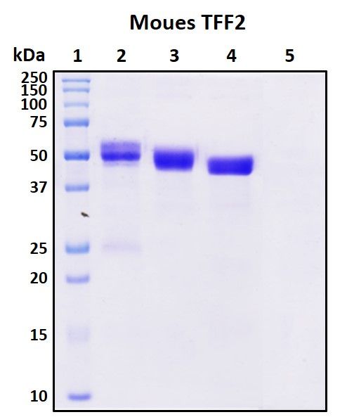 SDS-PAGE