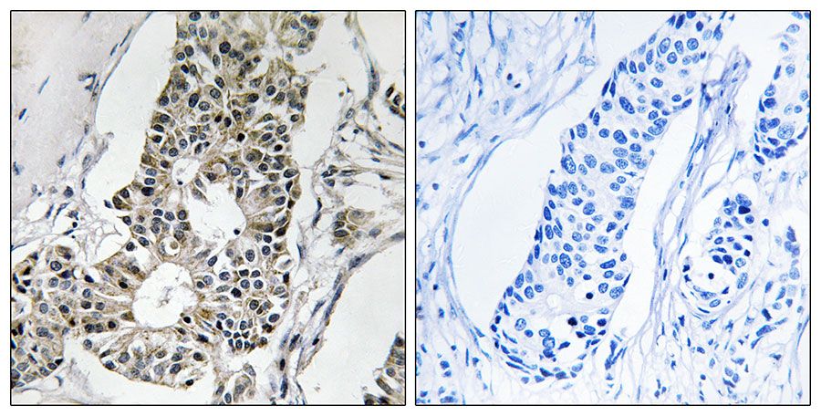 IHC