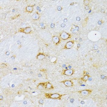 Immunohistochemistry - CCND1 Polyclonal Antibody (144-11022)