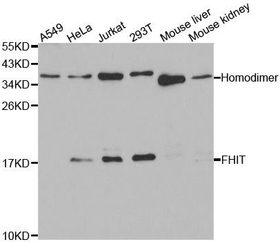 Western blot - FHIT antibody (144-01196)