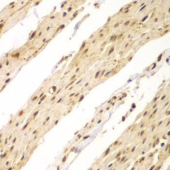 Immunohistochemistry - CDX1 antibody (144-05712)