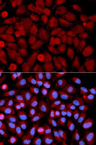 Immunohistochemistry - [KO Validated] MAPK9 Polyclonal Antibody (144-01251)