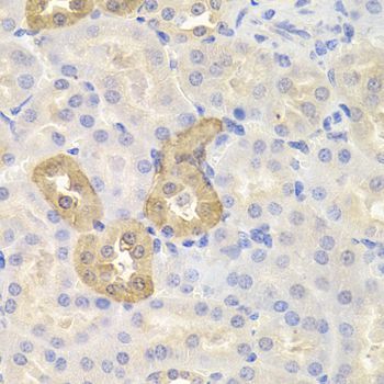 Immunohistochemistry - CHAF1B antibody (144-06259)