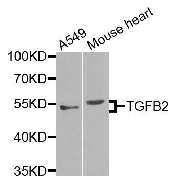 Western blot - TGFB2 Polyclonal Antibody (144-03640)