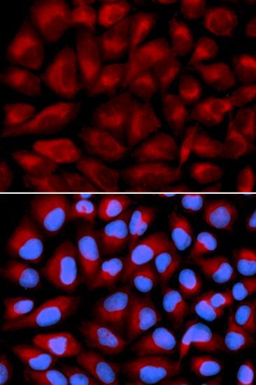 Immunofluorescence - FANCC antibody (144-01812)
