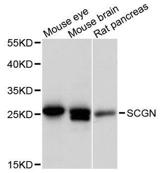 Western blot - SCGN antibody (144-12897)