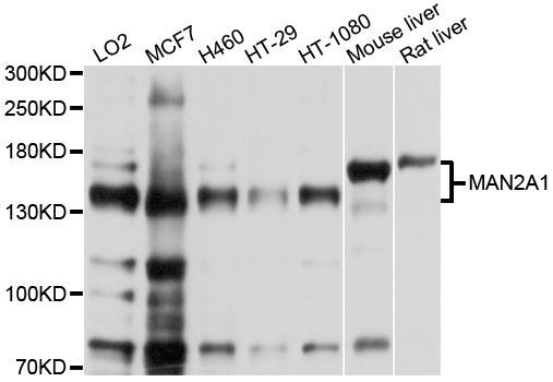 Western blot - MAN2A1 Polyclonal Antibody (144-600527)