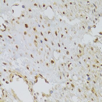 Immunohistochemistry - HNRNPA1 Polyclonal Antibody (144-07491)
