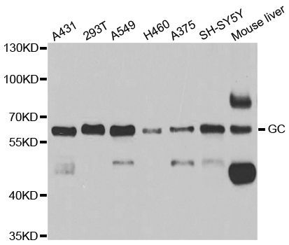 Western blot - GC Polyclonal Antibody (144-05709)
