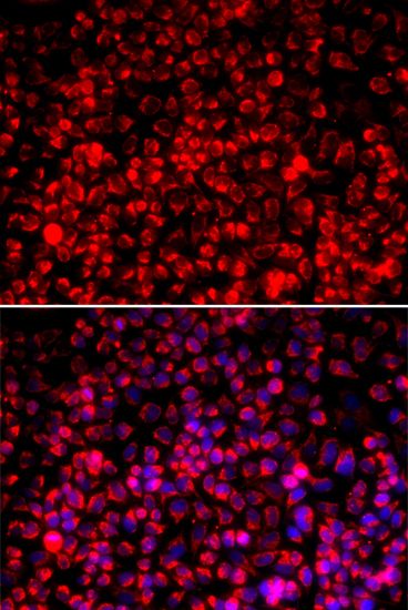 Immunofluorescence - TOMM20 antibody (144-06774)