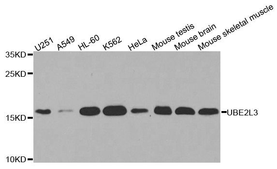 Western blot - UBE2L3 Polyclonal Antibody (144-04175)