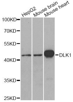 Western blot - DLK1 antibody (144-06578)