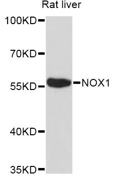 Western blot - NOX1 Polyclonal Antibody (144-011966)