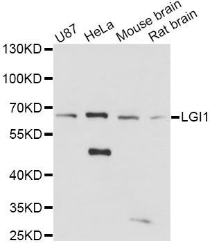 Western blot - LGI1 Polyclonal Antibody (144-61416)