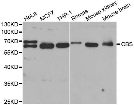 Western blot - CBS Polyclonal Antibody (144-01427)