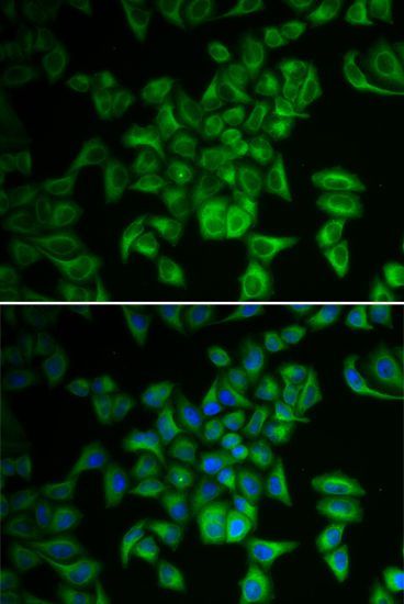Immunofluorescence - FXN antibody (144-01745)