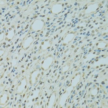 Immunohistochemistry - SAFB antibody (144-07927)