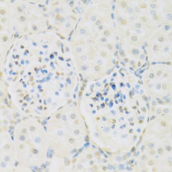 Immunohistochemistry - KAT2A Polyclonal Antibody (144-61334)