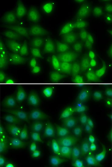 Immunofluorescence - RORA Polyclonal Antibody (144-06971)